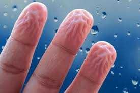علت چروک شدن پوست دست در آب