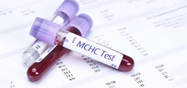 علت MCHC بالا در آزمایش خون چیست؟ 