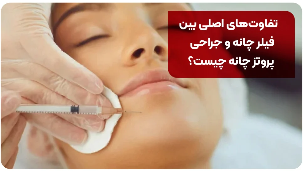 جراحی تفاوتهای اصلی بین فیلر چانه و جراحی پروتز چانه چیست؟