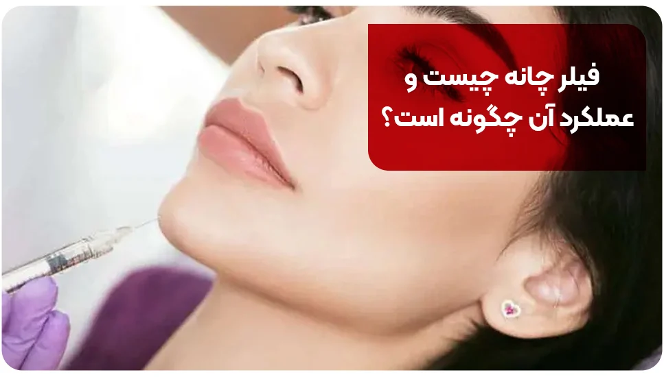 جراحی فیلر چانه چیست و عملکرد آن چگونه است؟