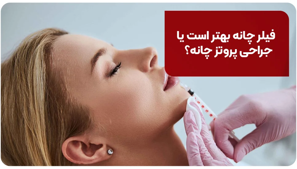 فیلر چانه بهتر است یا جراحی پروتز چانه؟