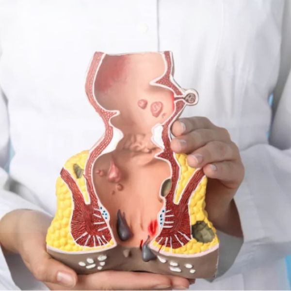بیماری بواسیر در چه سنی رخ میدهد؟
