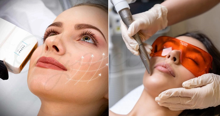 هایفو بهتر است یا فوتونا؟